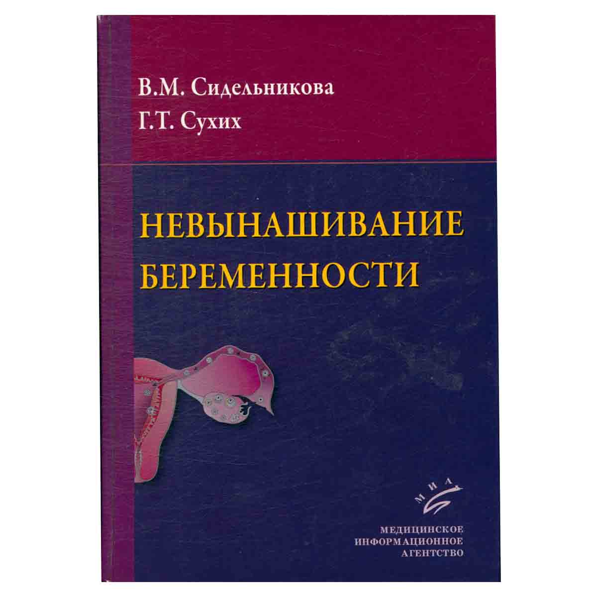 Невынашивание беременности