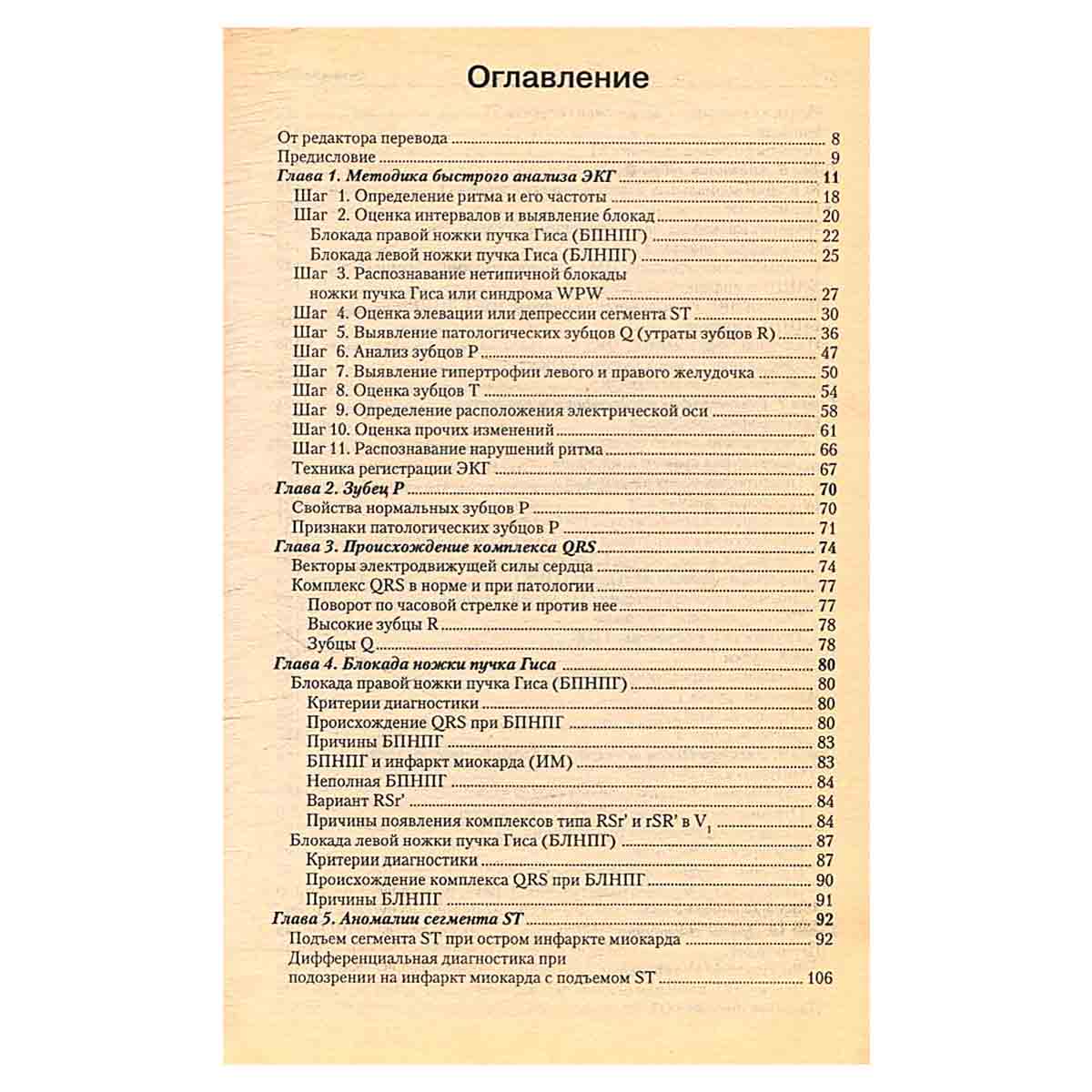 Быстрый анализ ЭКГ