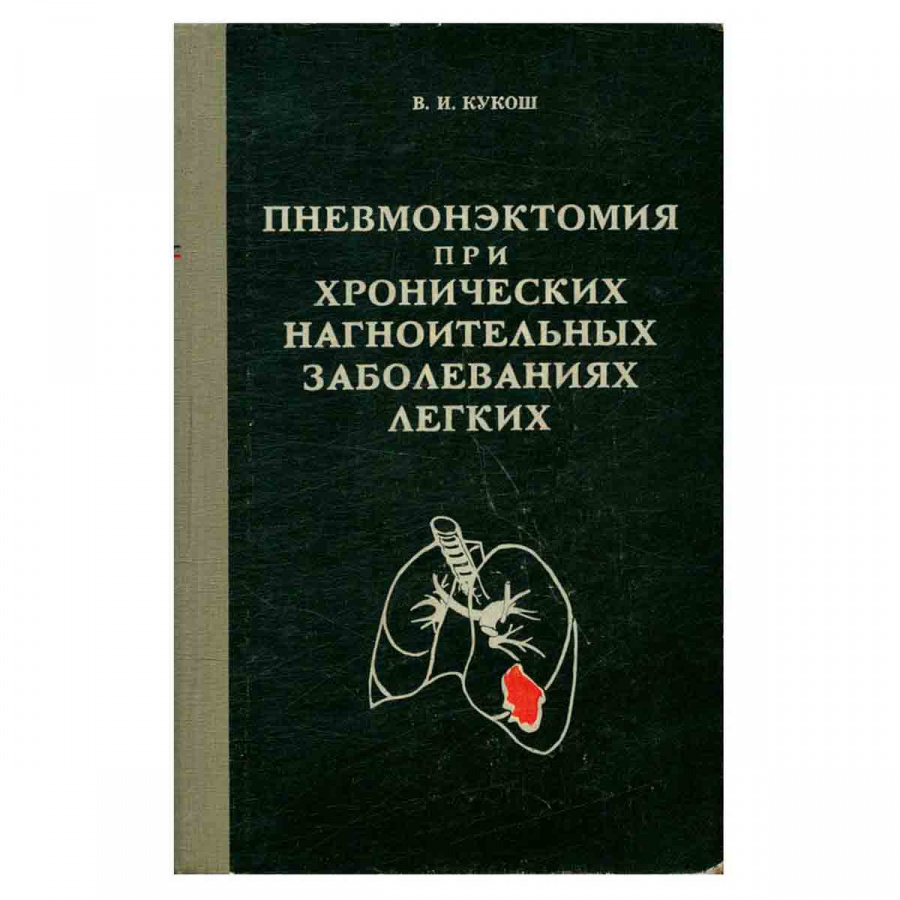 фото Пневмонэктомия при хронических нагноительных заболеваниях легких