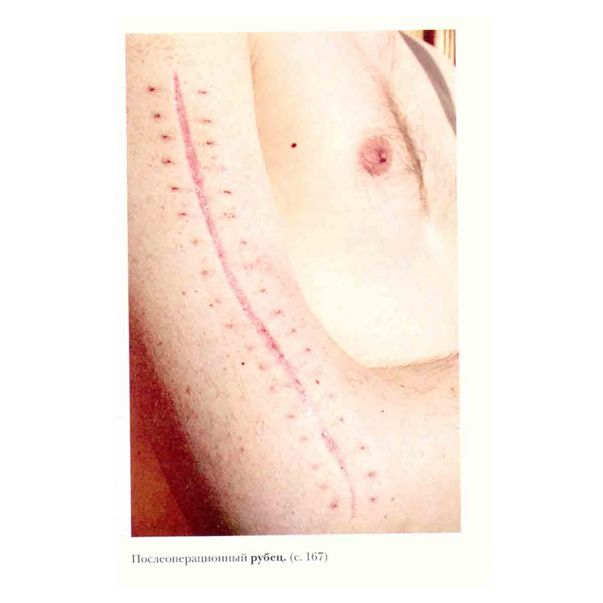 Большая медицинская энциклопедия в 30 томах. Том 16. Рап-Сар