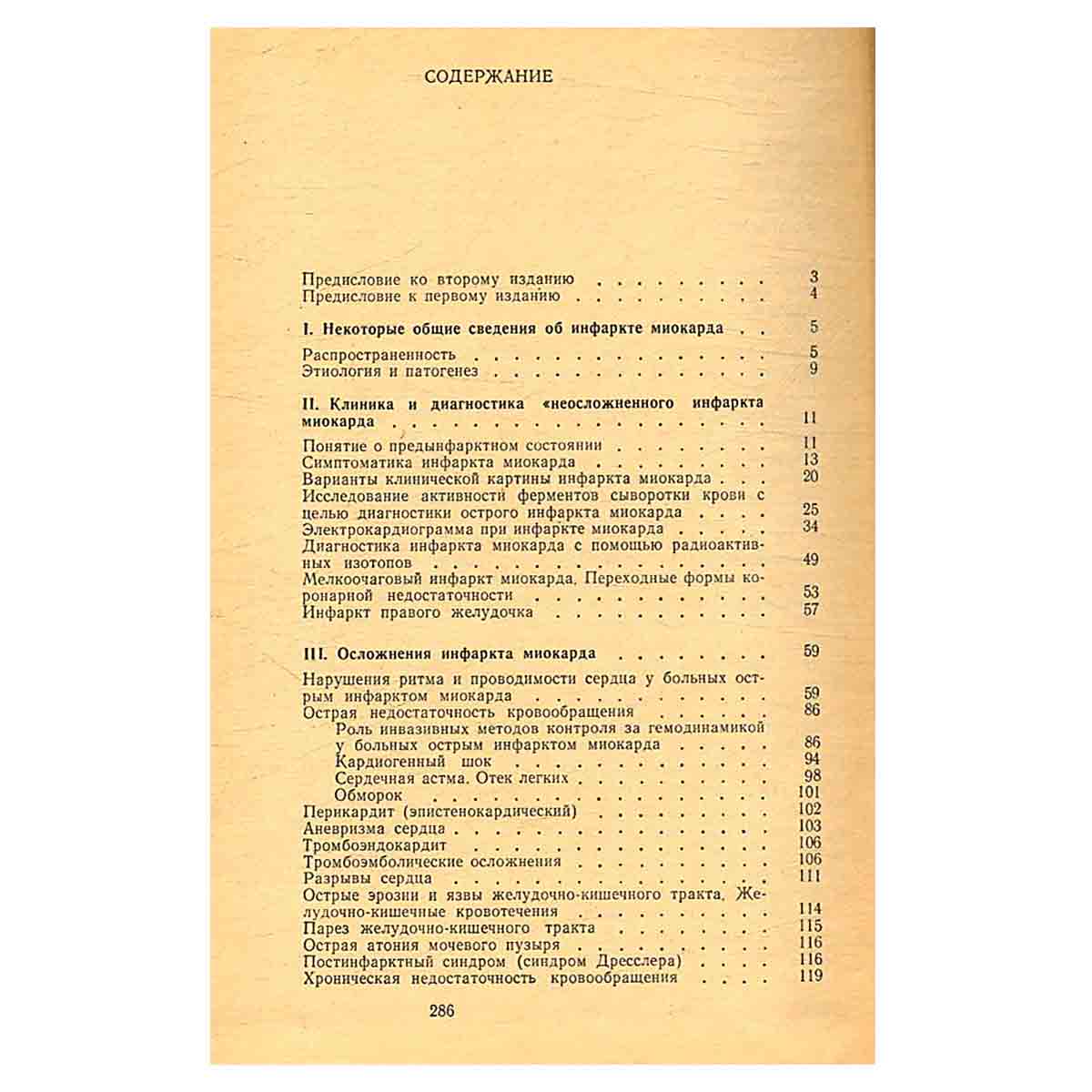 Инфаркт миокарда